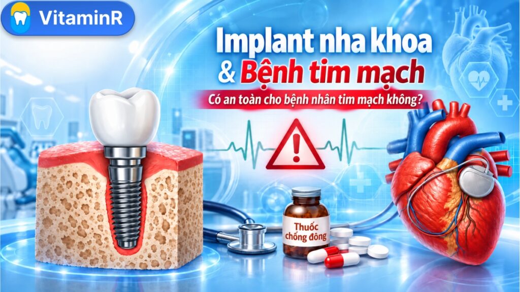 Bệnh tim mạch có trồng răng Implant được không – VitaminR