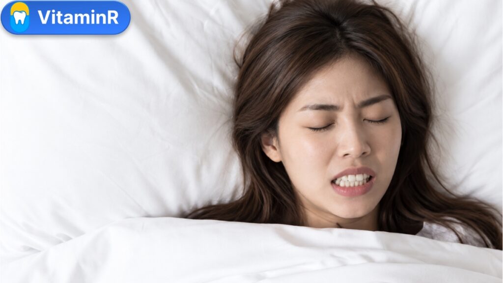 Cô gái nghiến chặt răng khi ngủ, yếu tố góp phần gây mòn, mẻ hoặc nứt răng