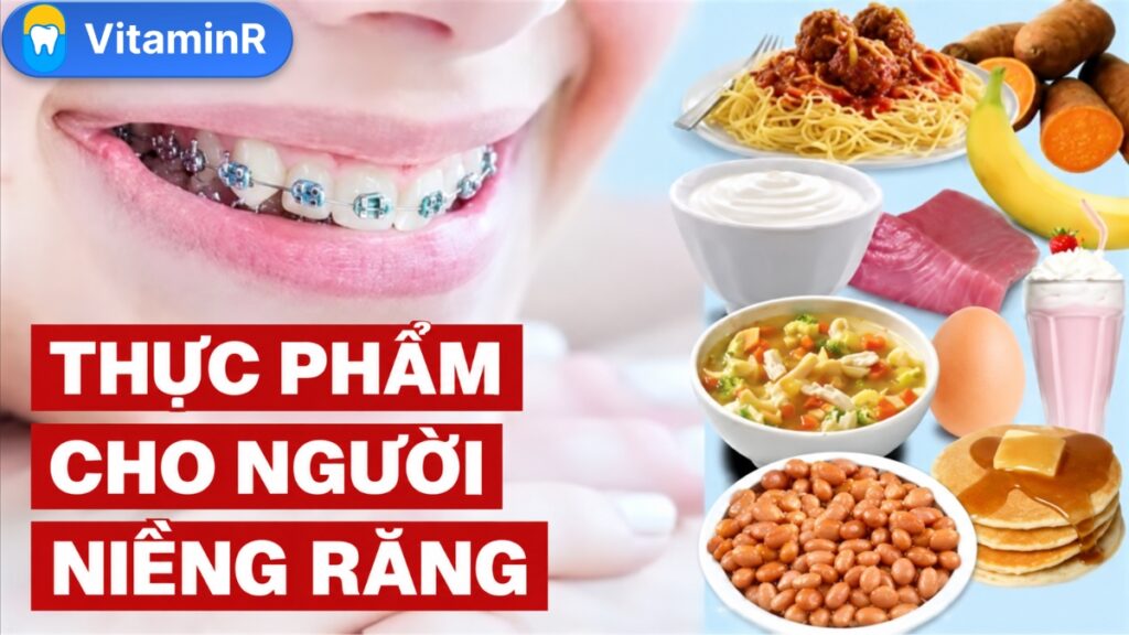 Người niềng răng nên ăn gì, hướng dẫn từ nha khoa vitaminr 