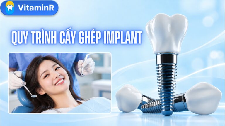 Ảnh minh họa quy trình trồng răng Implant với trụ Implant, mão răng và người bệnh tại Nha khoa VitaminR