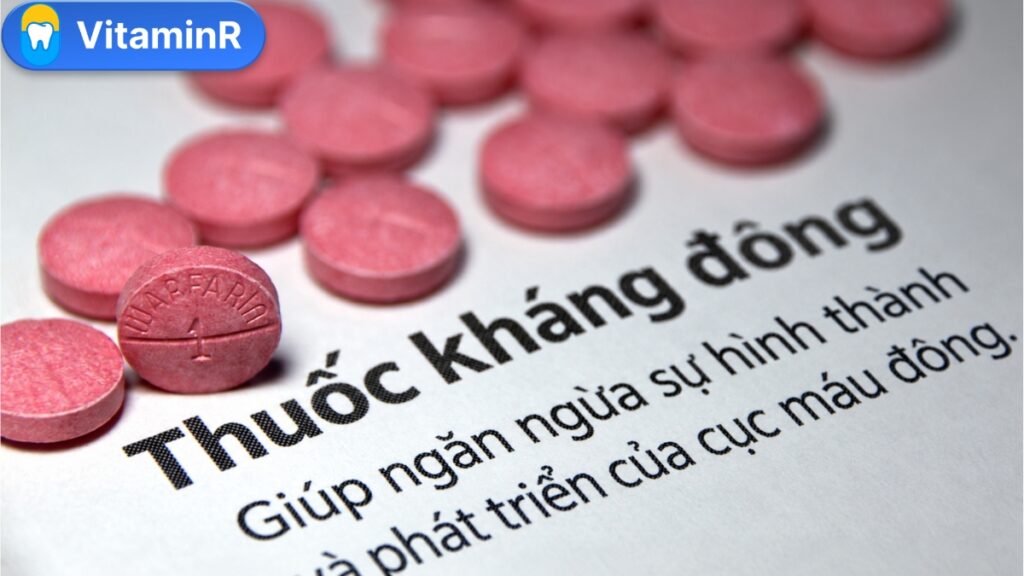 đang uống thuốc chống đông máu có trồng răng implant được không - vitaminr