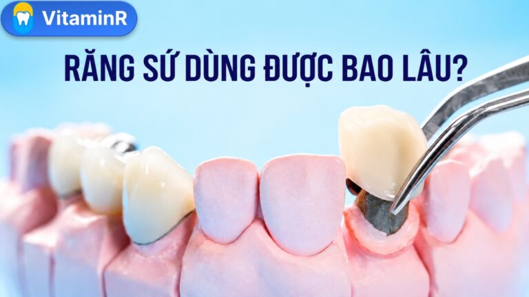 Mô hình mão sứ trên răng thật với tiêu đề Răng sứ dùng được bao lâu và logo VitaminR