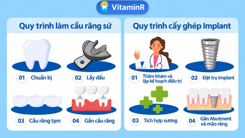 So sánh quy trình làm cầu răng sứ và cấy ghép Implant