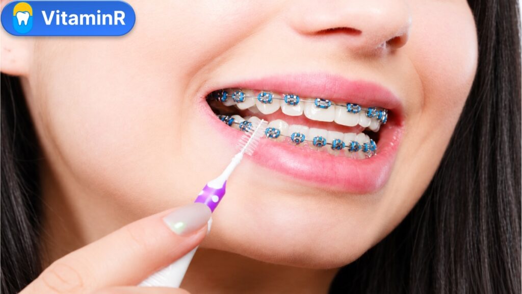 Dùng bàn chải kẽ làm sạch quanh mắc cài và dây cung, góc ảnh có logo VitaminR.